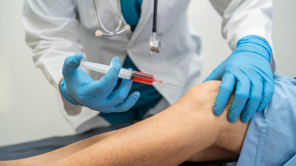 PRP IN AMBITO ORTOPEDICO